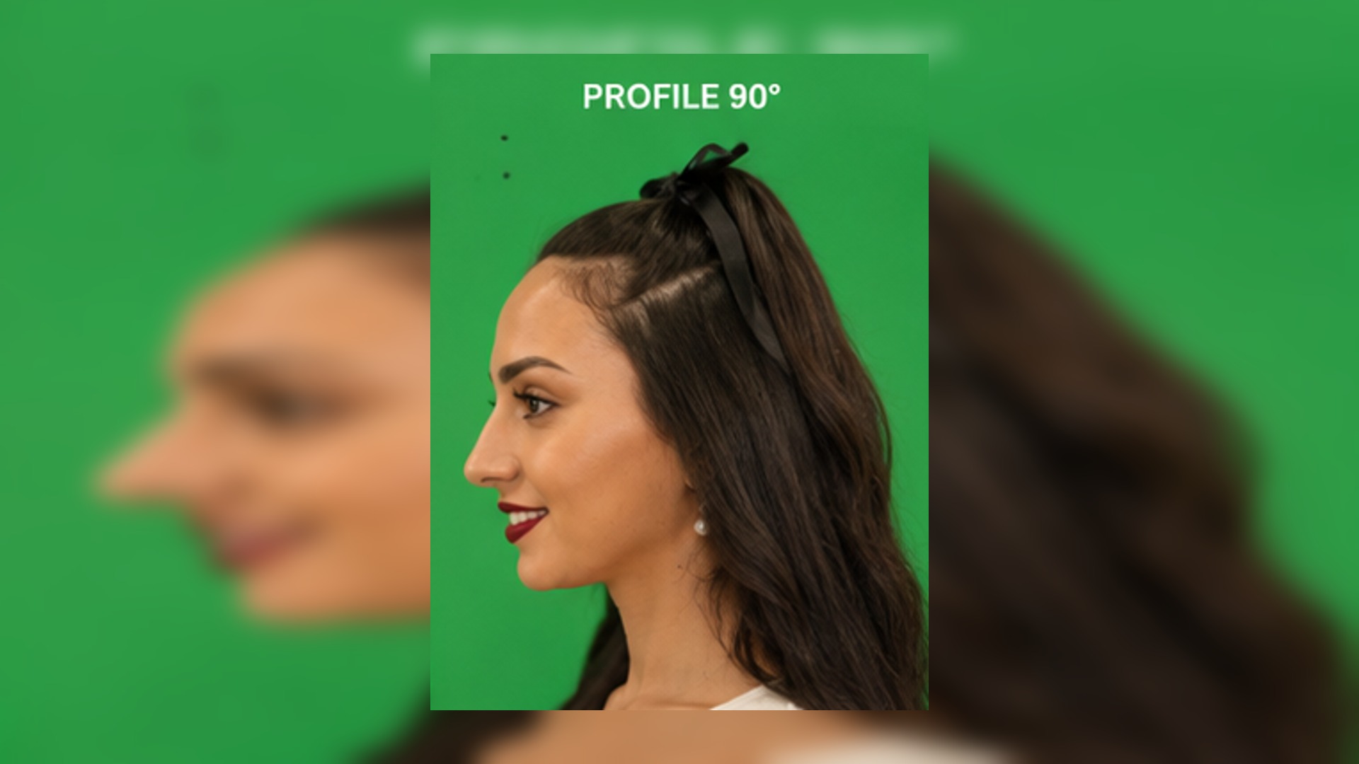 Reference Close-Up — Profile Smile thumbnail